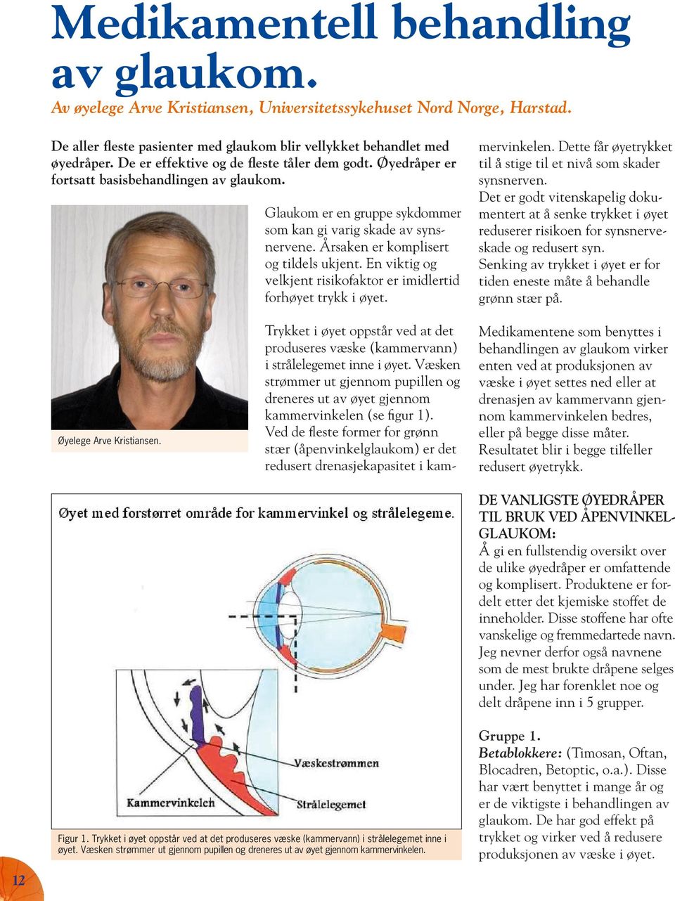 Årsaken er komplisert og tildels ukjent. En viktig og velkjent risikofaktor er imidlertid forhøyet trykk i øyet. mervinkelen. Dette får øyetrykket til å stige til et nivå som skader synsnerven.