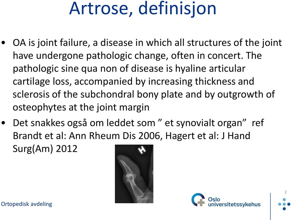 The pathologic sine qua non of disease is hyaline articular cartilage loss, accompanied by increasing thickness and