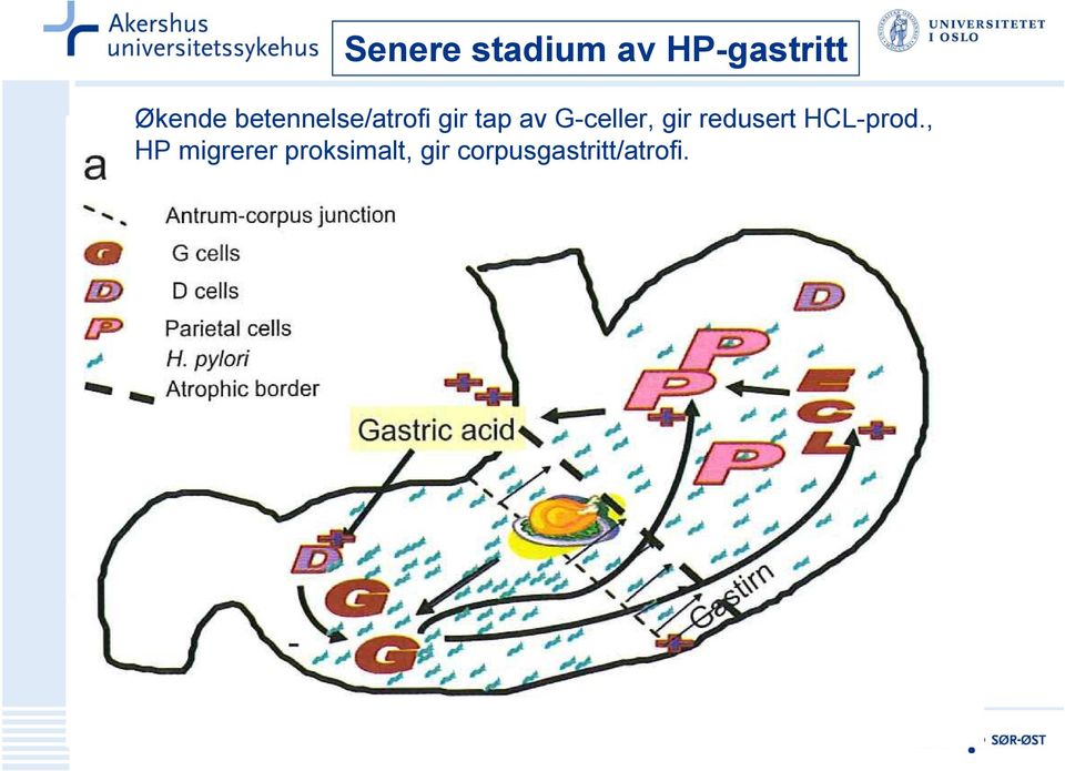 G-celler, gir redusert HCL-prod.