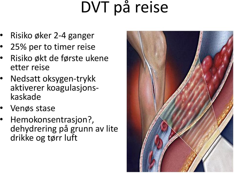 aktiverer koagulasjonskaskade Venøs stase