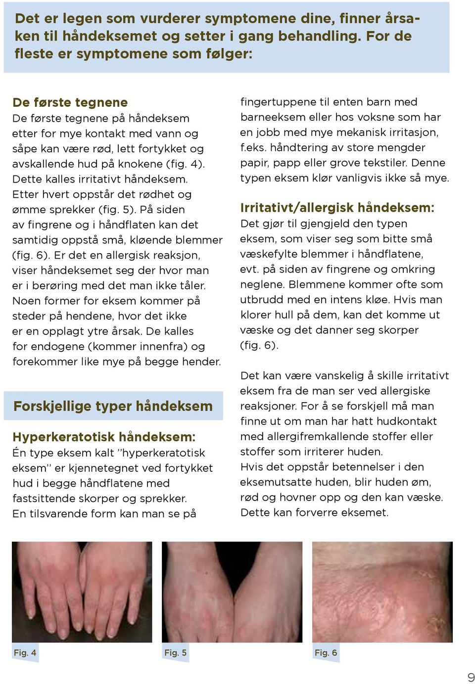 Dette kalles irritativt håndeksem. Etter hvert oppstår det rødhet og ømme sprekker (fig. 5). På siden av fingrene og i håndflaten kan det samtidig oppstå små, kløende blemmer (fig. 6).