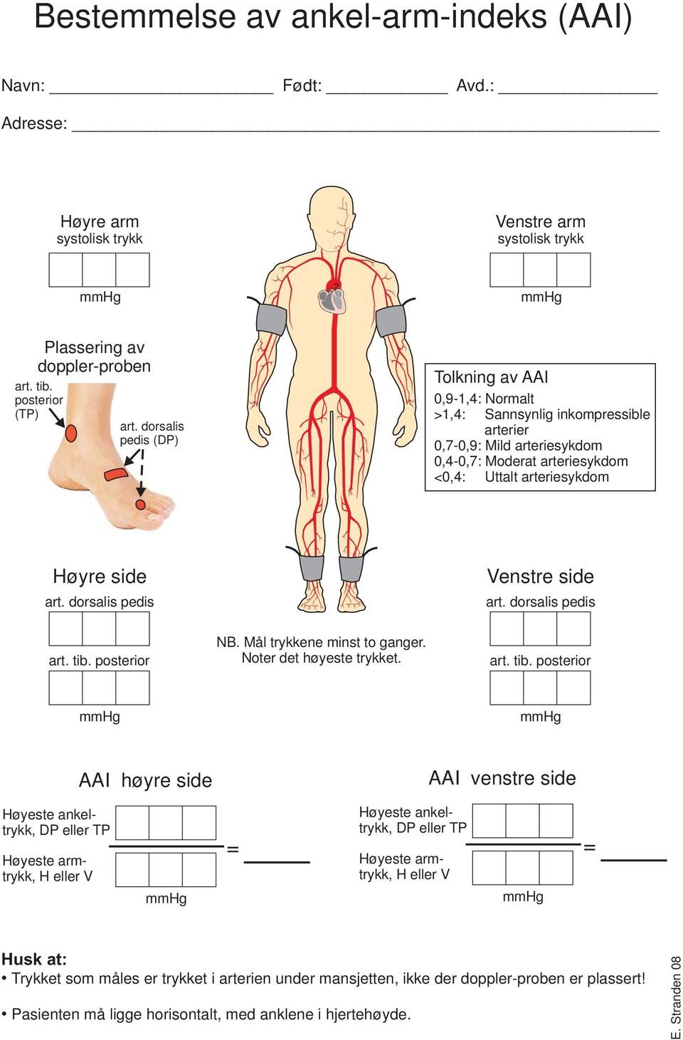 dorsalis pedis (DP) Tolkning av AAI 0,9-1,4: Normalt >1,4: Sannsynlig inkompressible arterier 0,7-0,9: Mild arteriesykdom 0,4-0,7: Moderat arteriesykdom <0,4: Uttalt arteriesykdom Høyre side art.