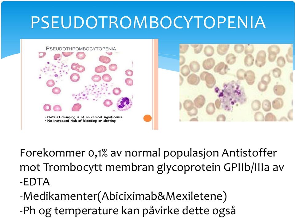 glycoprotein GPIIb/IIIa av -EDTA
