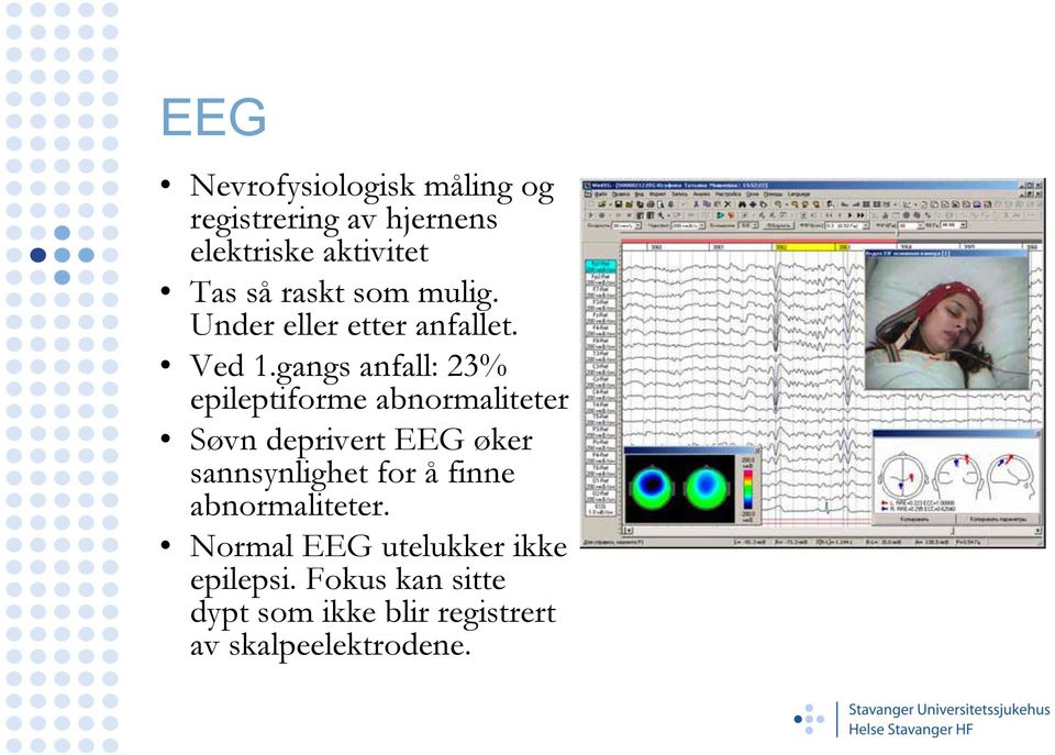 gangs anfall: 23% epileptiforme abnormaliteter Søvn deprivert EEG øker sannsynlighet