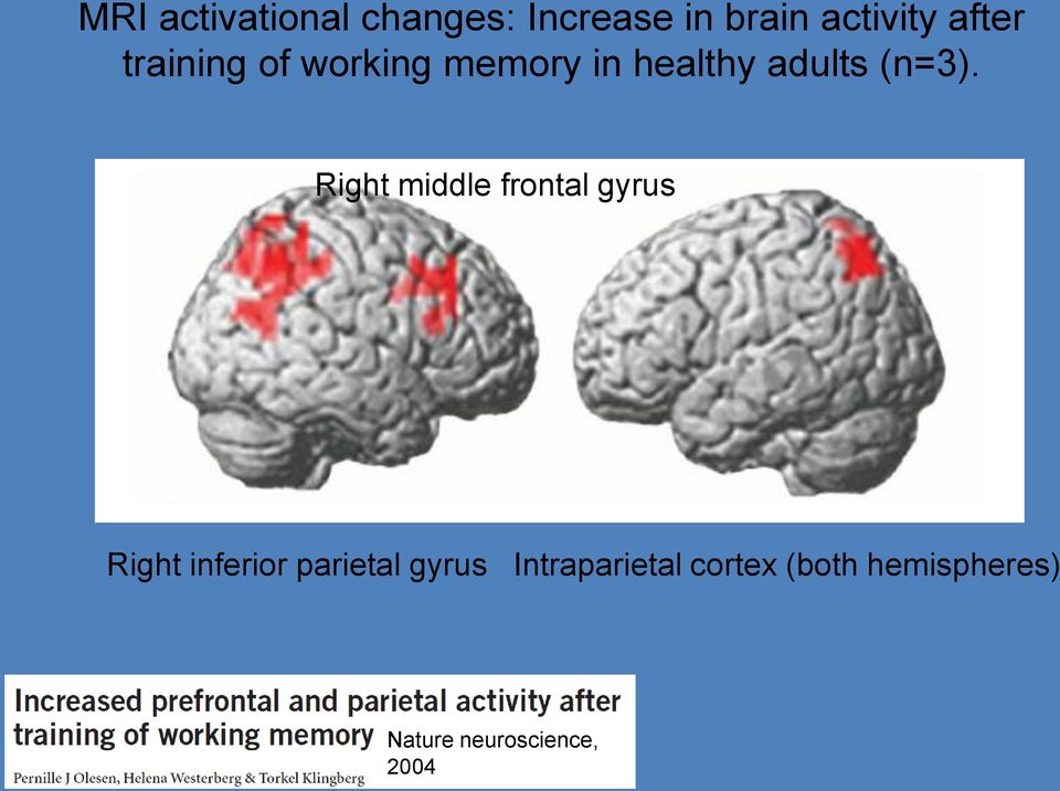 Right middle frontal gyrus Right inferior parietal gyrus