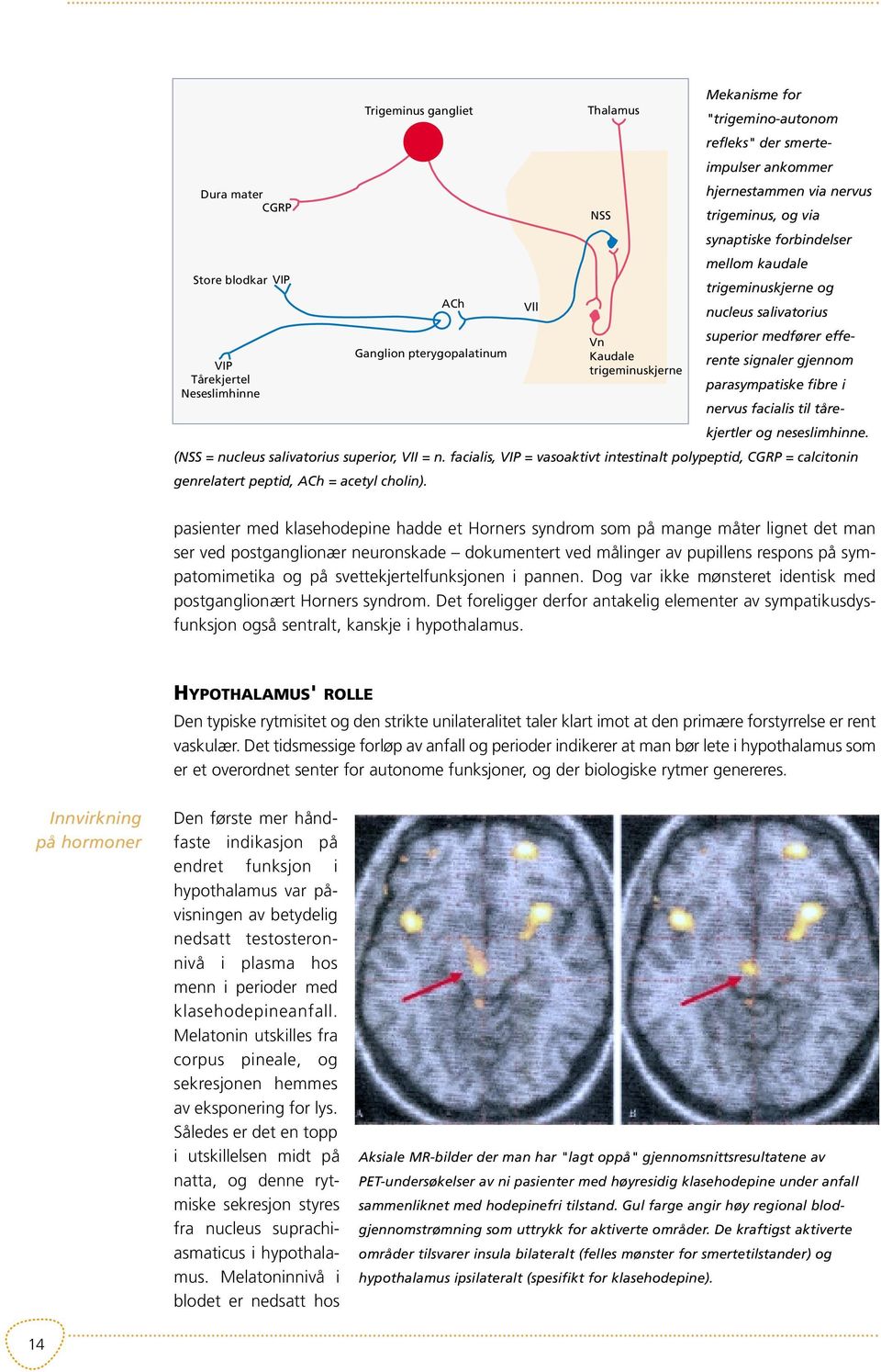 parasympatiske fibre i Neseslimhinne nervus facialis til tårekjertler og neseslimhinne. (NSS = nucleus salivatorius superior, VII = n.