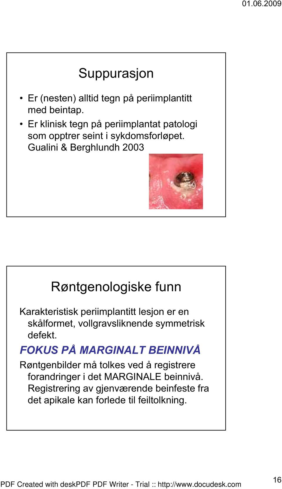 Gualini & Berghlundh 2003 Røntgenologiske funn Karakteristisk periimplantitt lesjon er en skålformet, vollgravsliknende