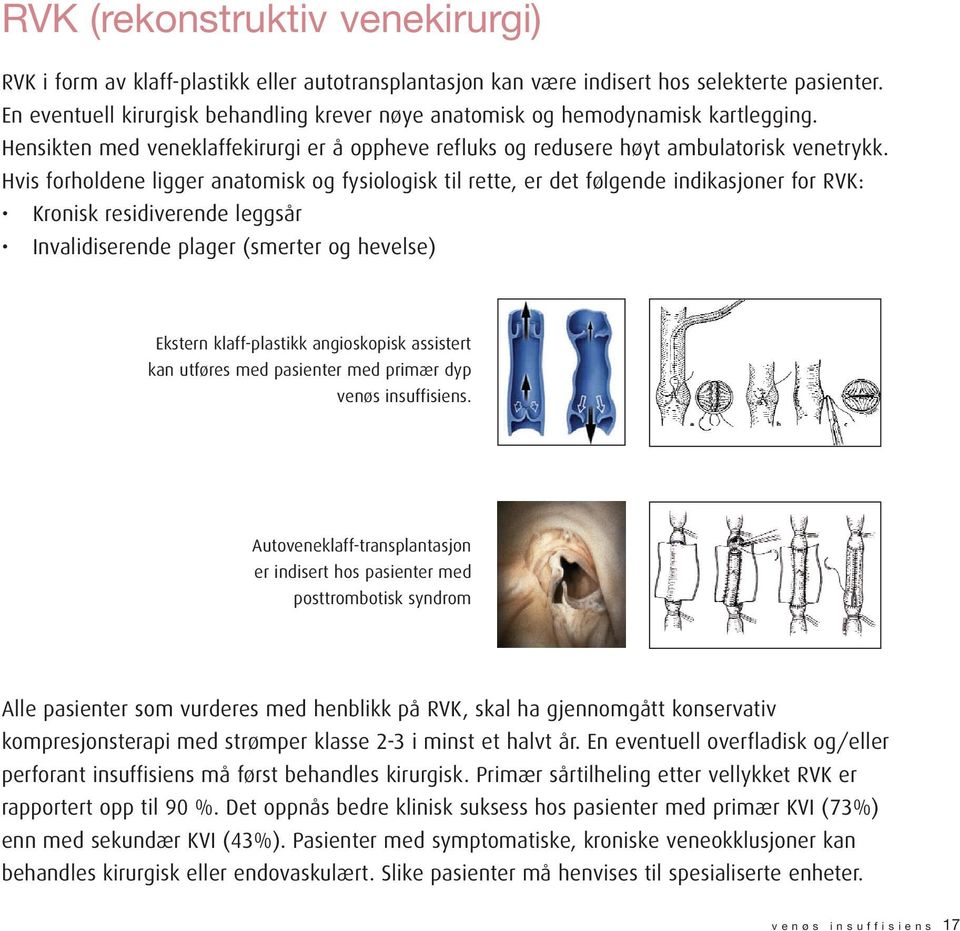 Hvis forholdene ligger anatomisk og fysiologisk til rette, er det følgende indikasjoner for RVK: Kronisk residiverende leggsår Invalidiserende plager (smerter og hevelse) Ekstern klaff-plastikk