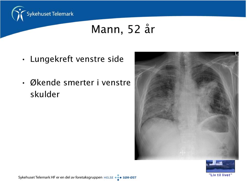 venstre side