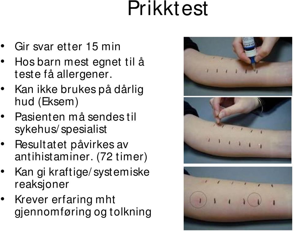 sykehus/spesialist Resultatet påvirkes av antihistaminer.