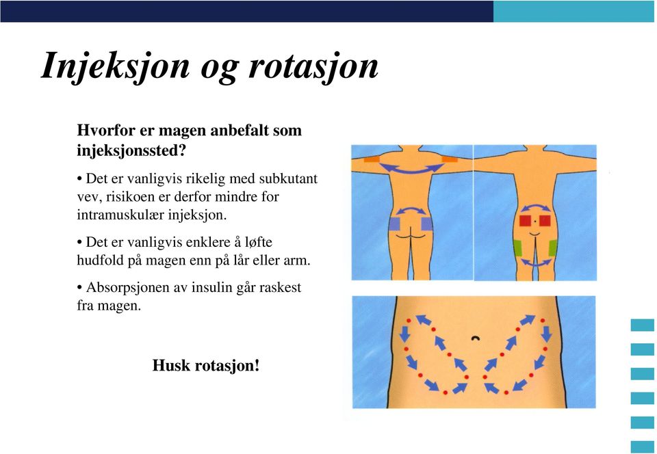 intramuskulær injeksjon.