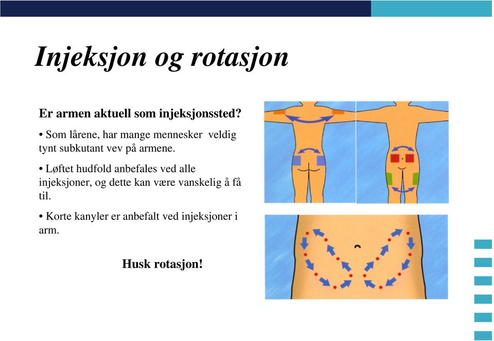 Løftet hudfold anbefales ved alle injeksjoner, og dette kan være