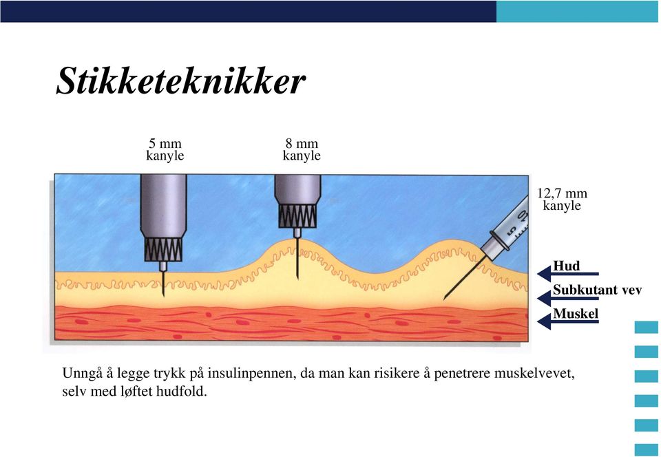 legge trykk på insulinpennen, da man kan