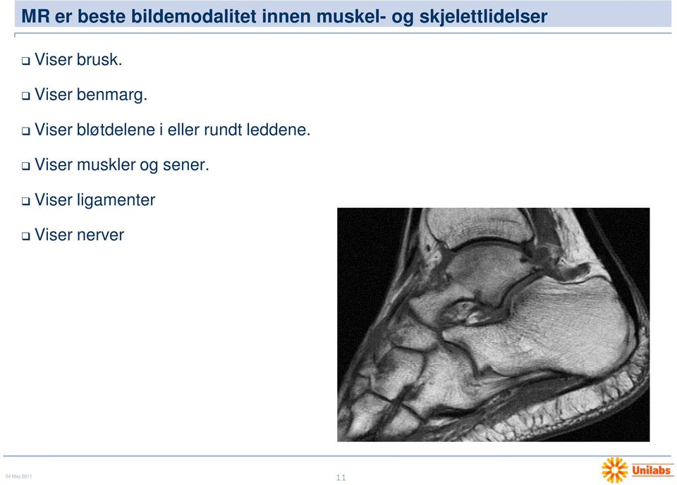 Viser bløtdelene i eller rundt leddene.