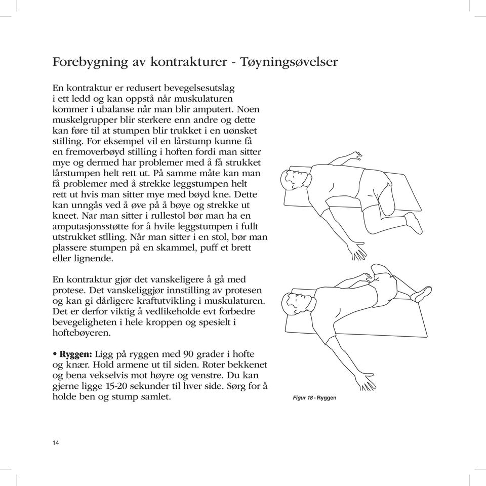 For eksempel vil en lårstump kunne få en fremoverbøyd stilling i hoften fordi man sitter mye og dermed har problemer med å få strukket lårstumpen helt rett ut.