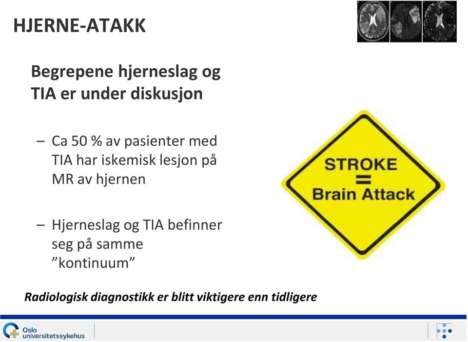 lesjon på MR av hjernen Hjerneslag og TIA befinner seg på