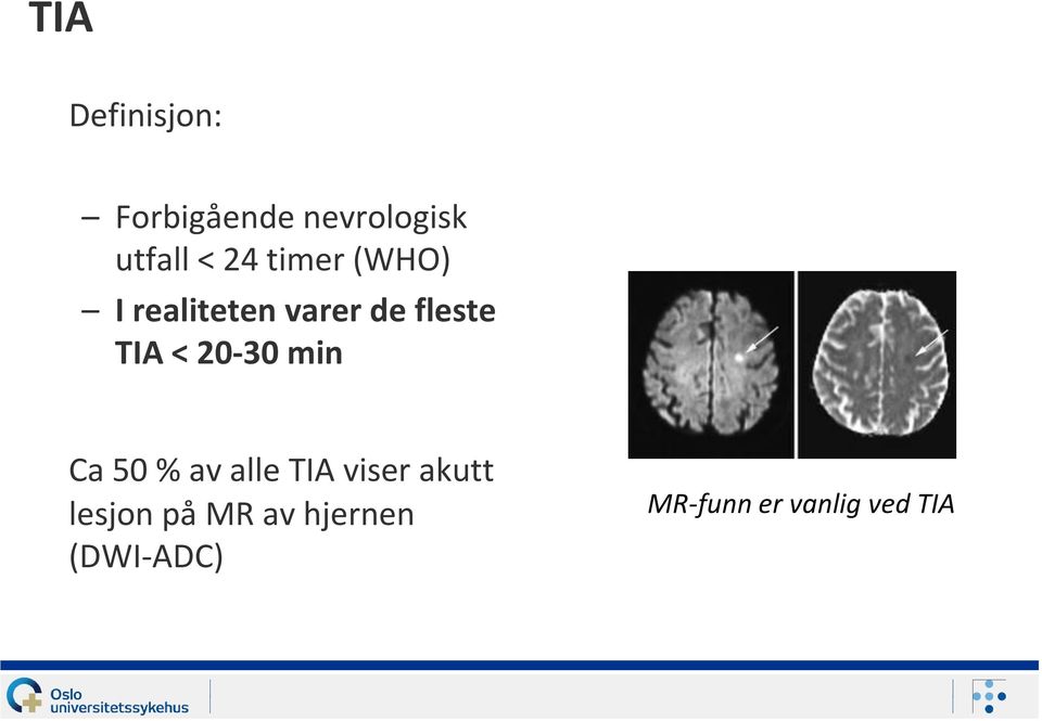 20-30 min Ca 50 % av alle TIA viser akutt lesjon