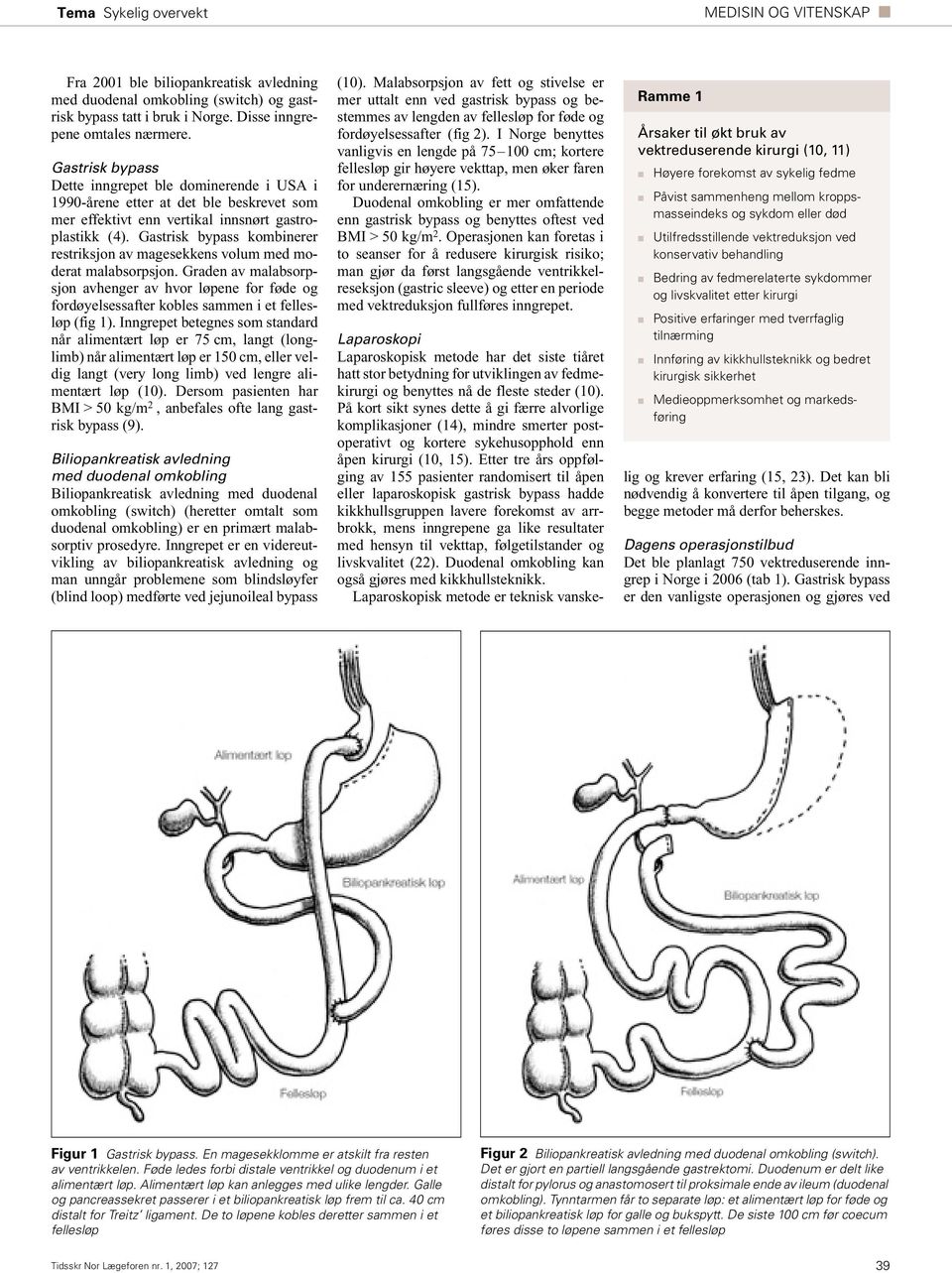 Gastrisk bypass kombinerer restriksjon av magesekkens volum med moderat malabsorpsjon.