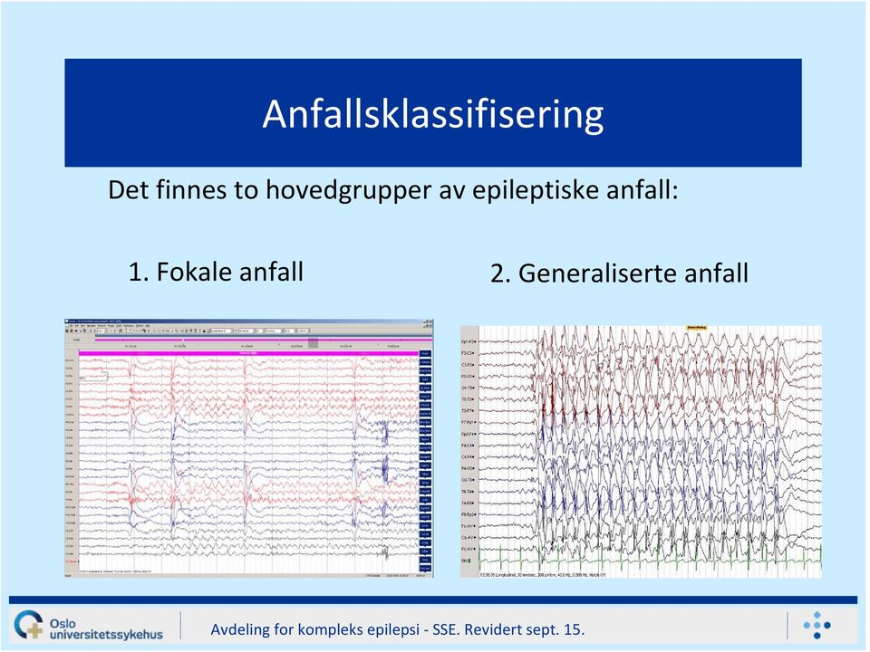 epileptiske anfall: 1.