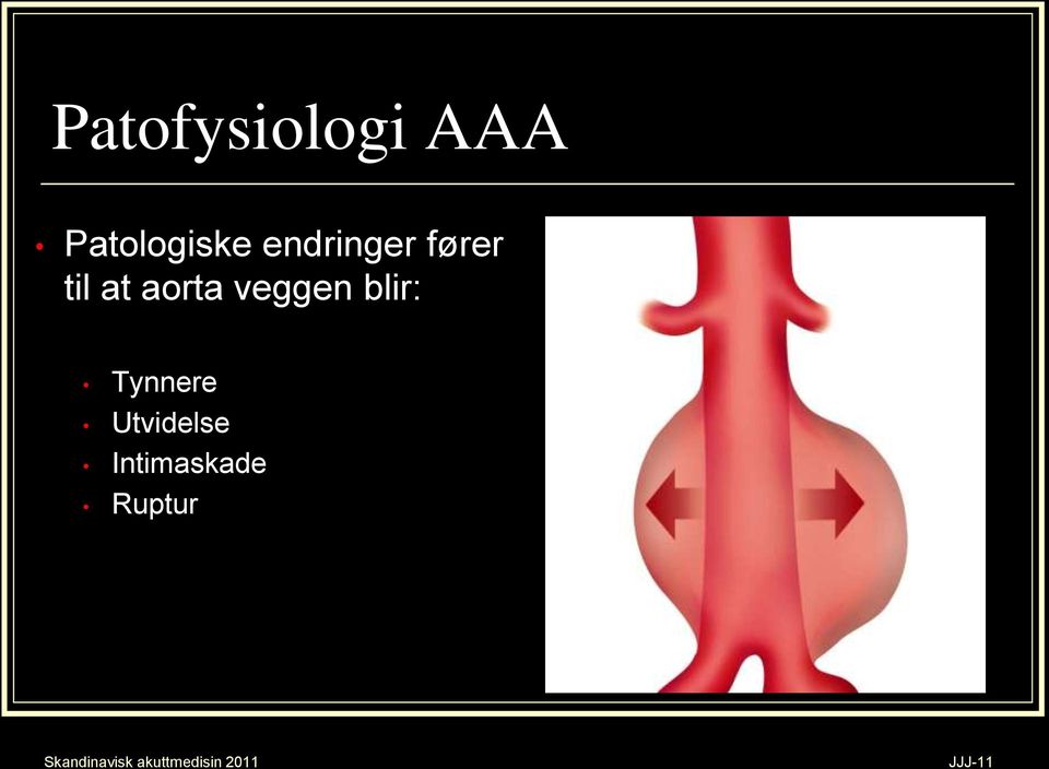 fører til at aorta veggen