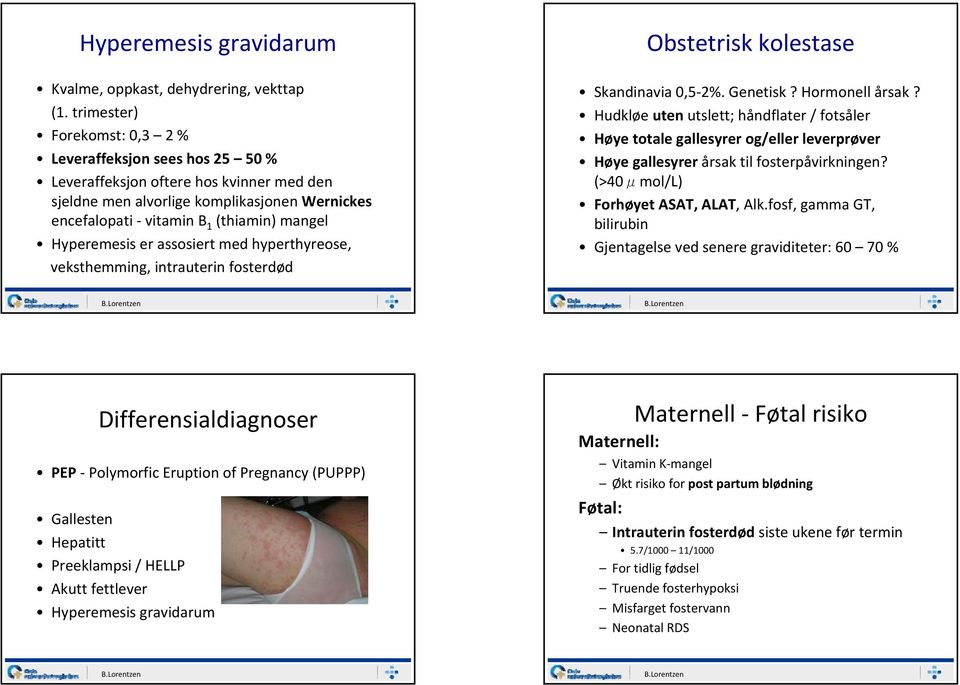 Hyperemesis er assosiert med hyperthyreose, veksthemming, intrauterin fosterdød Obstetrisk kolestase Skandinavia 0,5 2%. Genetisk? Hormonell årsak?