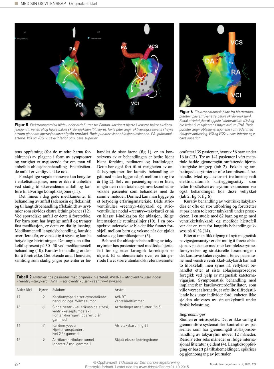 cava superior Figur 6 Elektroanatomisk bilde fra hjertetransplantert pasient (venstre bakre skråprojeksjon).