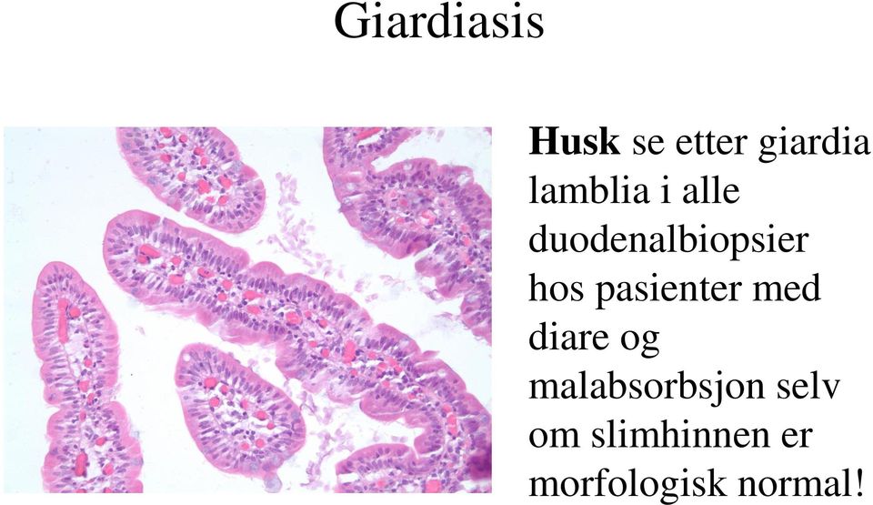 pasienter med diare og malabsorbsjon