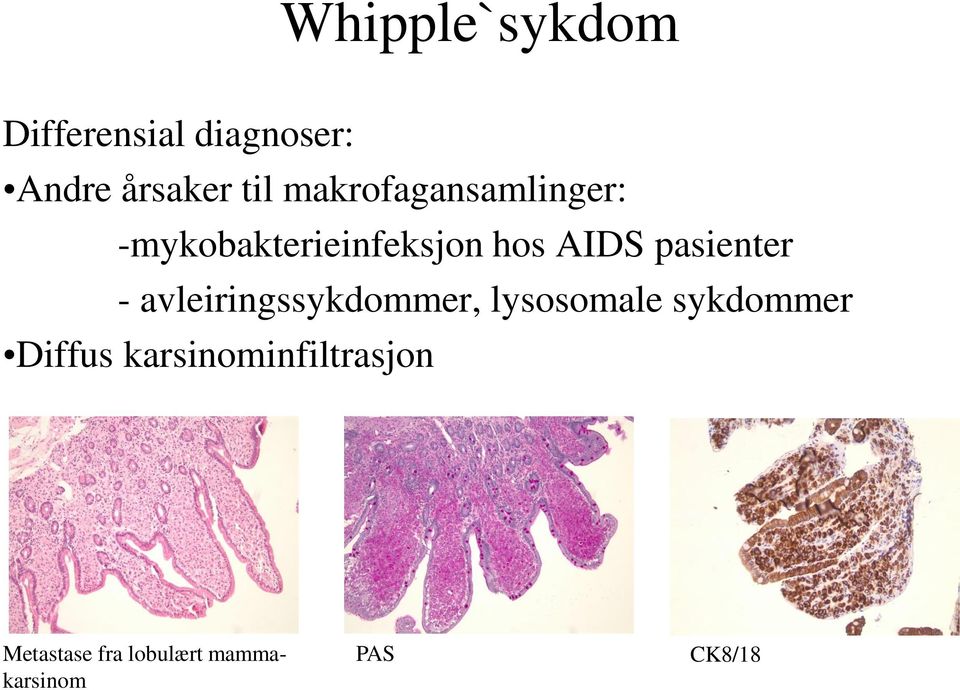 pasienter - avleiringssykdommer, lysosomale sykdommer