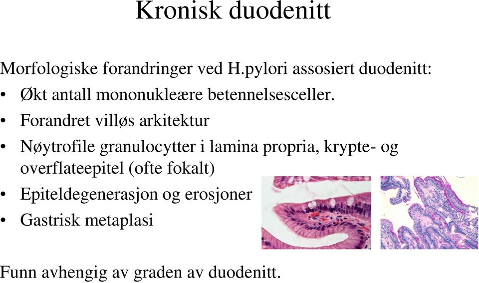 Forandret villøs arkitektur Nøytrofile granulocytter i lamina propria, krypte-