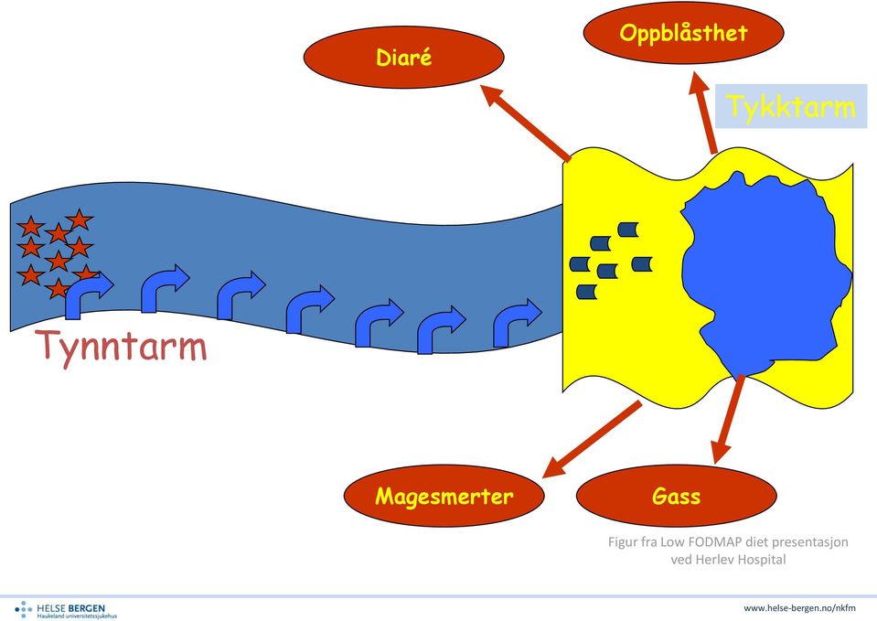 Figur fra Low FODMAP diet