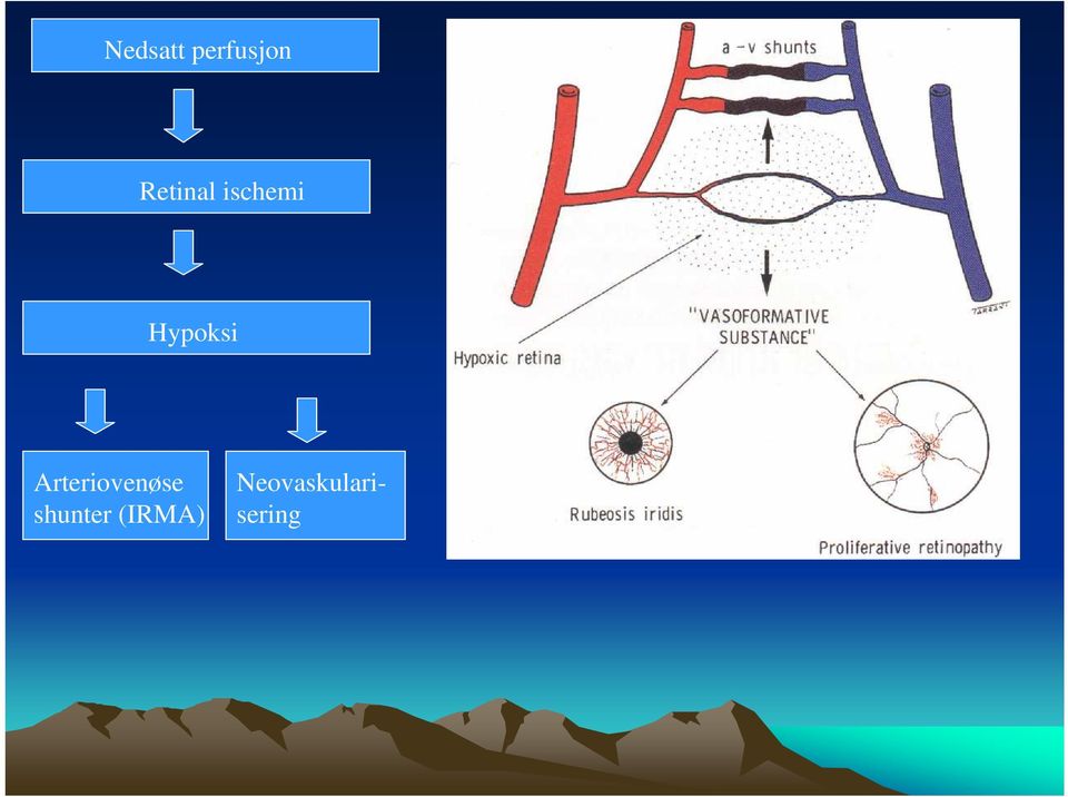 Hypoksi Arteriovenøse