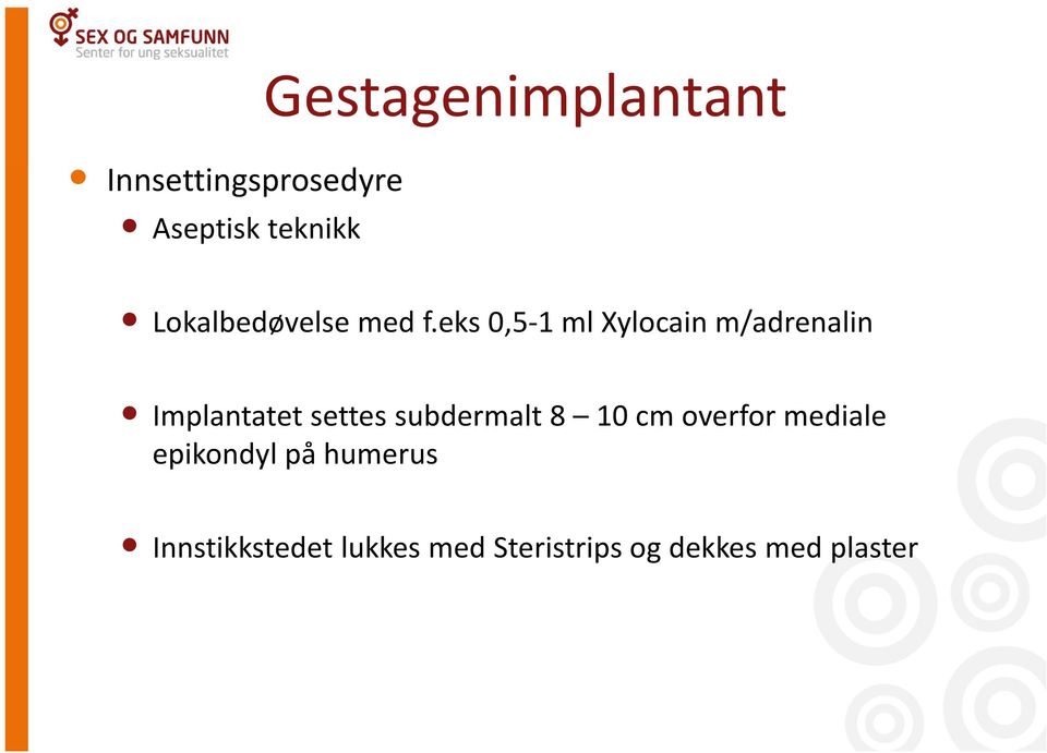 eks 0,5-1 ml Xylocain m/adrenalin Implantatet settes