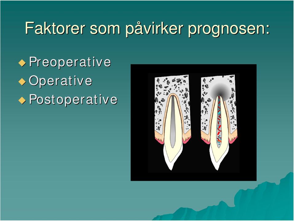 prognosen: