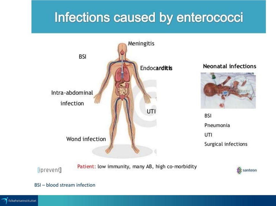 infection