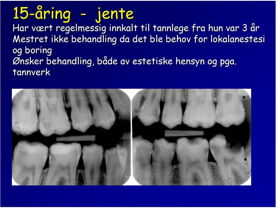 da det ble behov for lokalanestesi og boring Ønsker