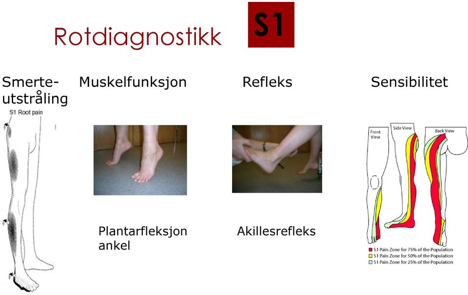 Sensibilitet utstråling