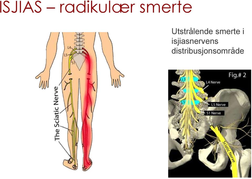 smerte i