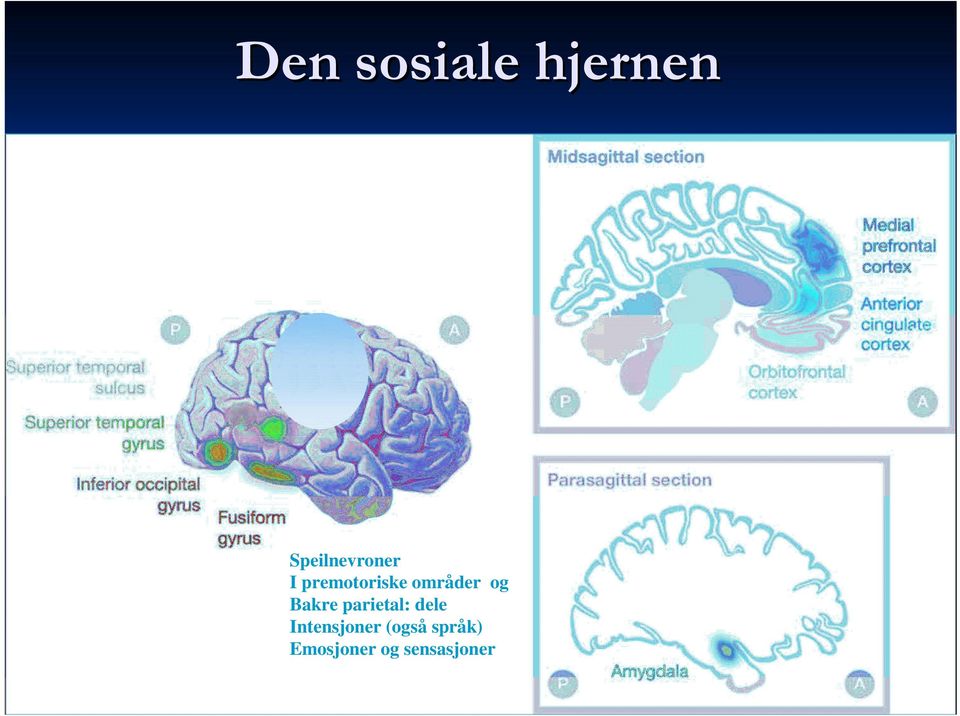 områder og Bakre parietal: dele