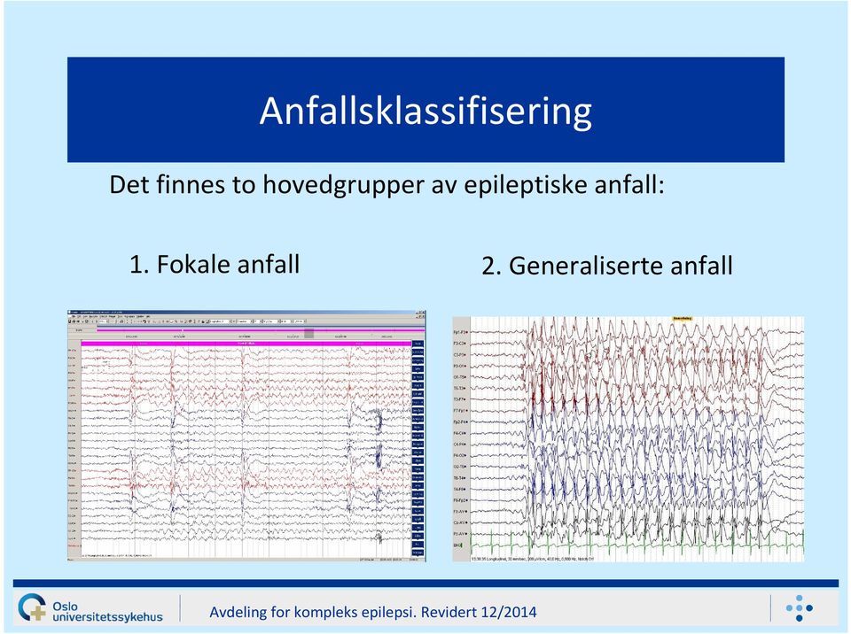 epileptiske anfall: 1.