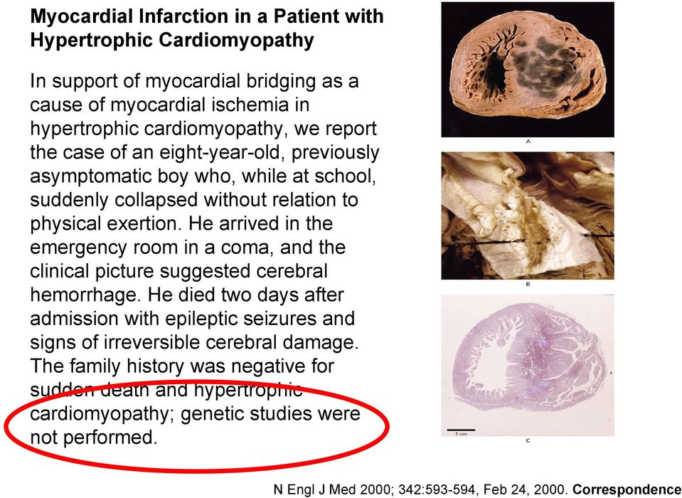 He arrived in the emergency room in a coma, and the clinical picture suggested cerebral hemorrhage.