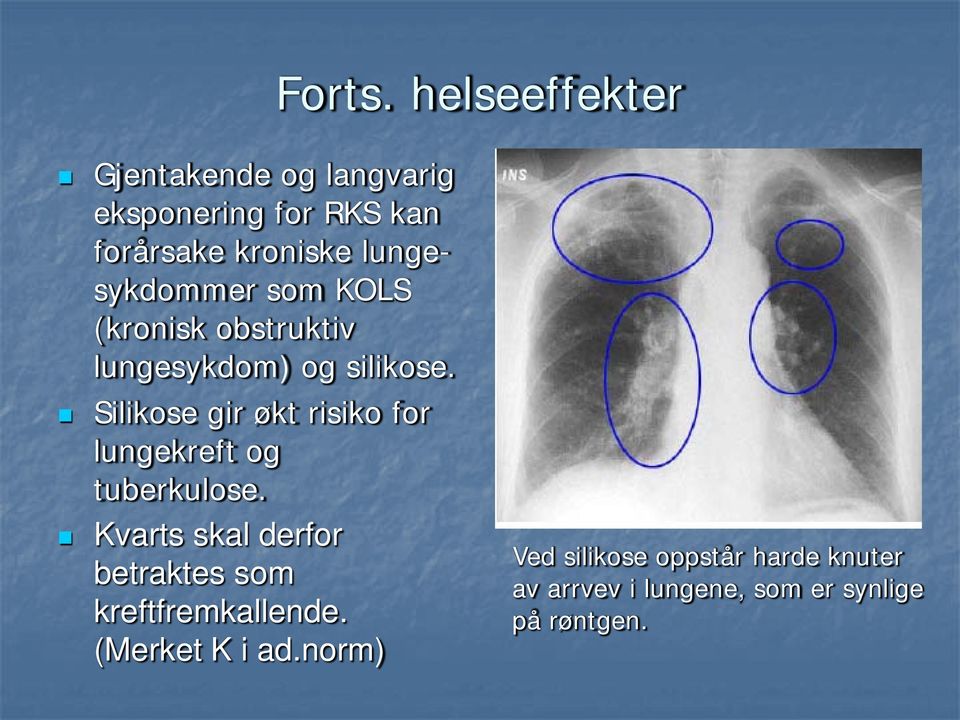 lungesykdommer som KOLS (kronisk obstruktiv lungesykdom) og silikose.