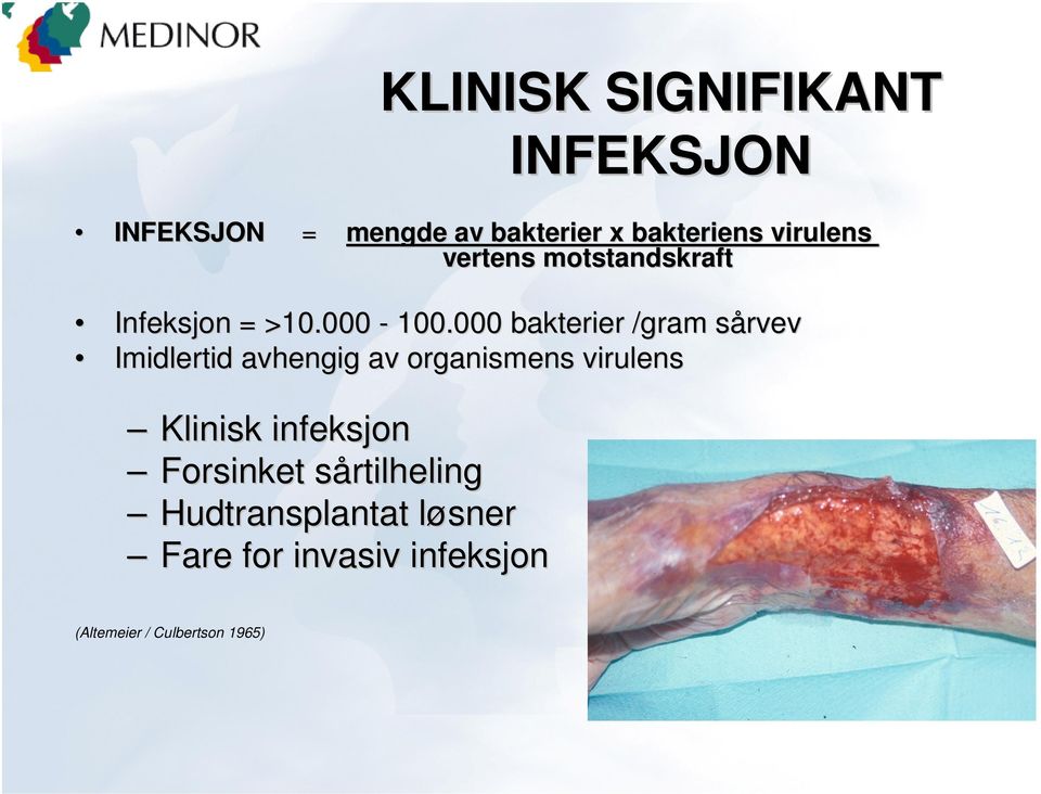 000 bakterier /gram sårvevs Imidlertid avhengig av organismens virulens Klinisk