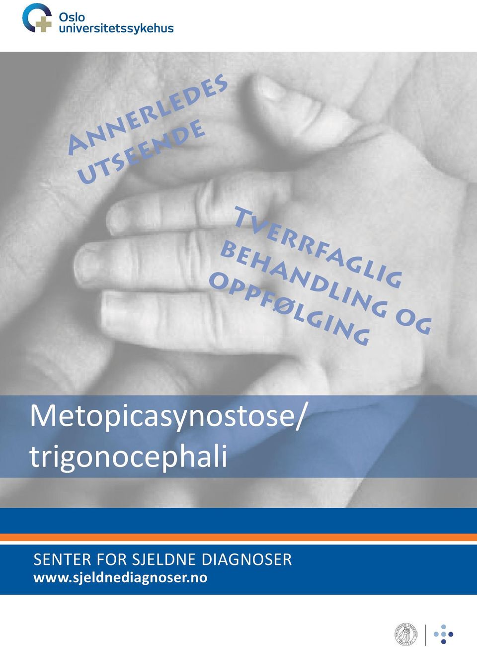 Metopicasynostose/ trigonocephali