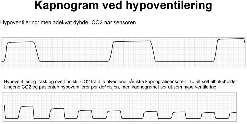 Hypoventilering: rask og overfladisk- CO2 fra alle alveolene når ikke kapnografisensoren.