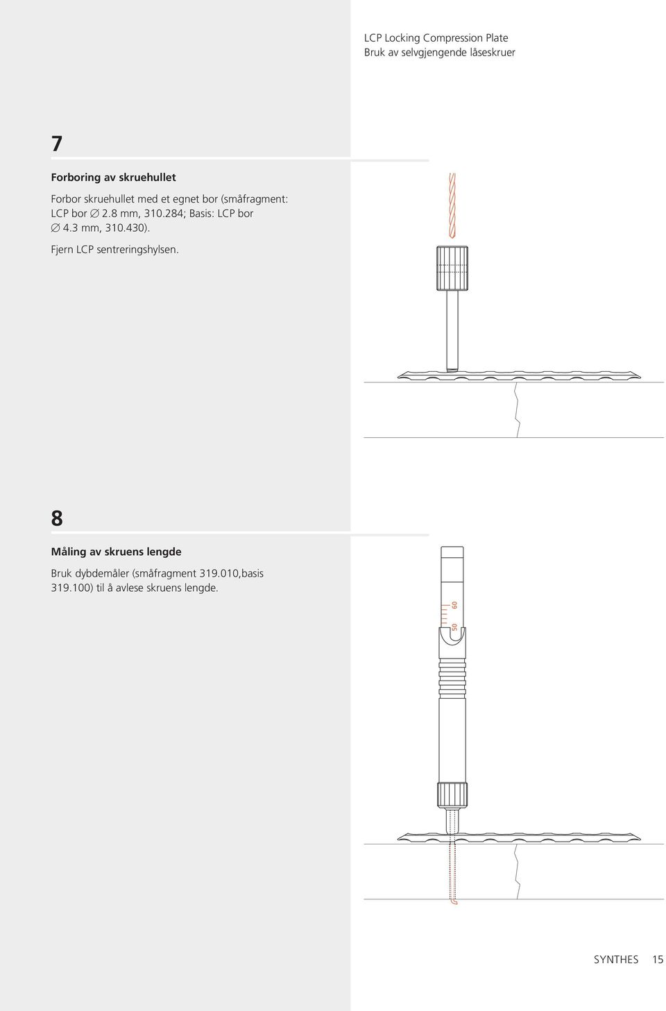 3 mm, 310.430). Fjern LCP sentreringshylsen.