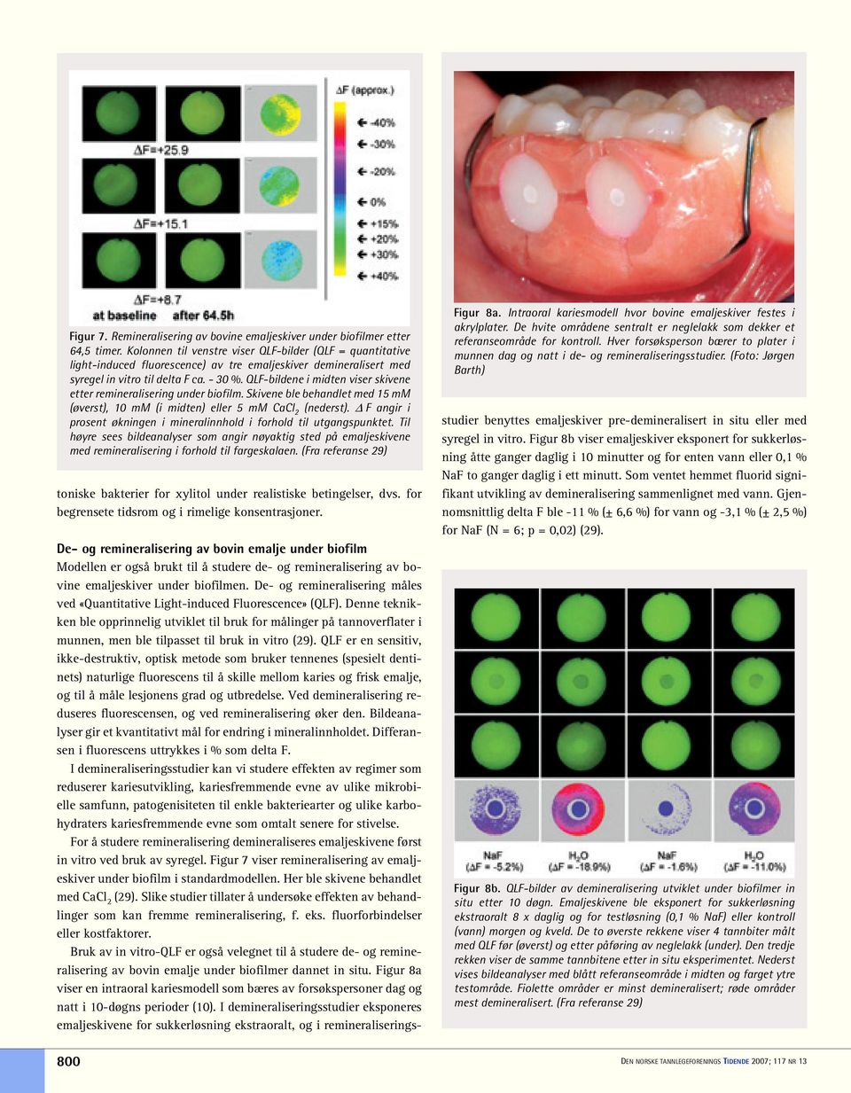 QLF-bildene i midten viser skivene etter remineralisering under biofilm. Skivene ble behandlet med 15 mm (øverst), 10 mm (i midten) eller 5 mm CaCl 2 (nederst).