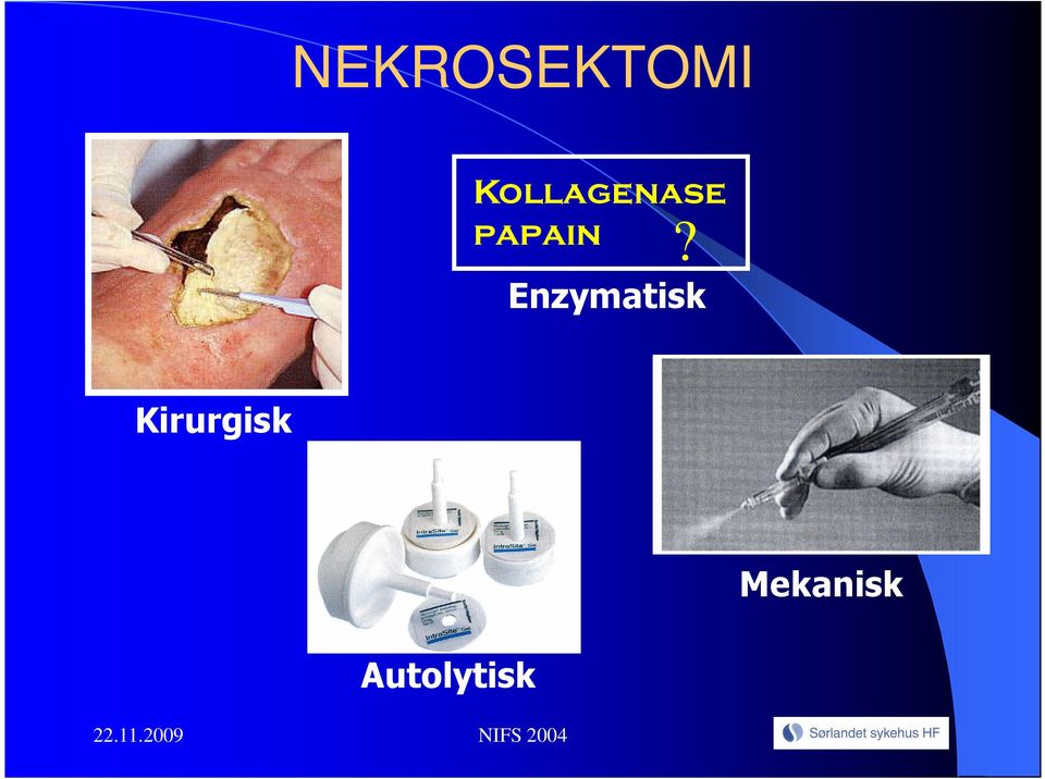 Enzymatisk Kirurgisk