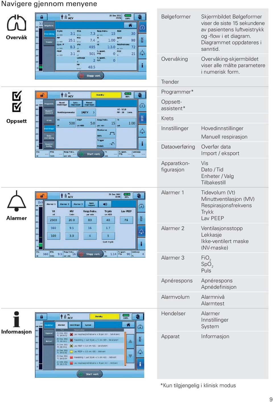 Hovedinnstillinger Manuell respirasjon Overfør data Import / eksport Vis Dato / Tid Enheter / Valg Tilbakestill Tidevolum (Vt) Minuttventilasjon (MV) Respirasjonsfrekvens Trykk Lav PEEP