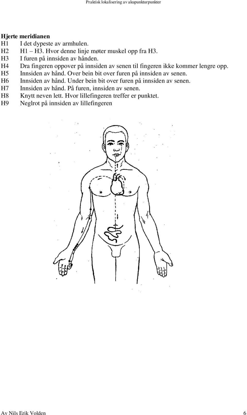 H5 Innsiden av hånd. Over bein bit over furen på innsiden av senen. H6 Innsiden av hånd.