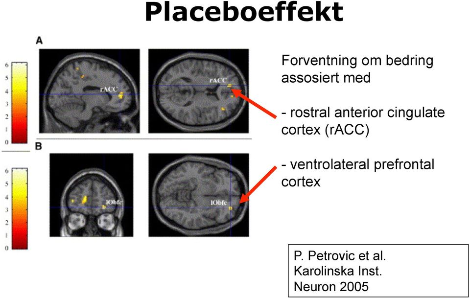 cortex (racc) - ventrolateral prefrontal